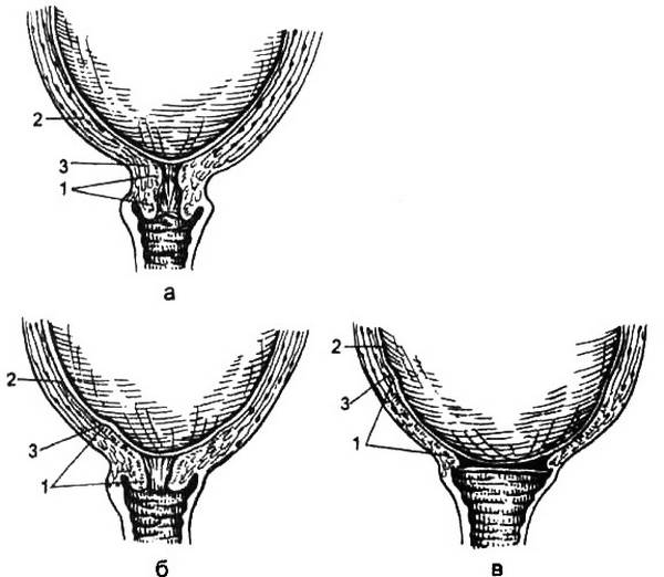 Цервикальный канал шейки матки | компетентно о здоровье на ilive