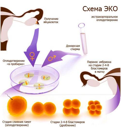 Перенос эмбрионов при эко - процедура переноса замороженных эмбрионов после криоконсервации в gms эко