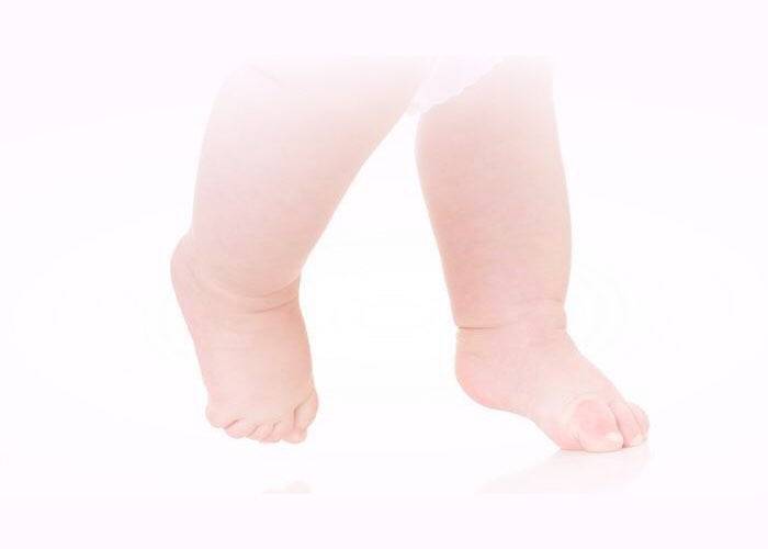 Почему ребенок ходит на носочках. ребенок ходит на цыпочках