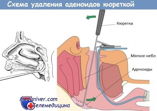 Образ жизни после удаления желчного пузыря / блог / клиника эксперт