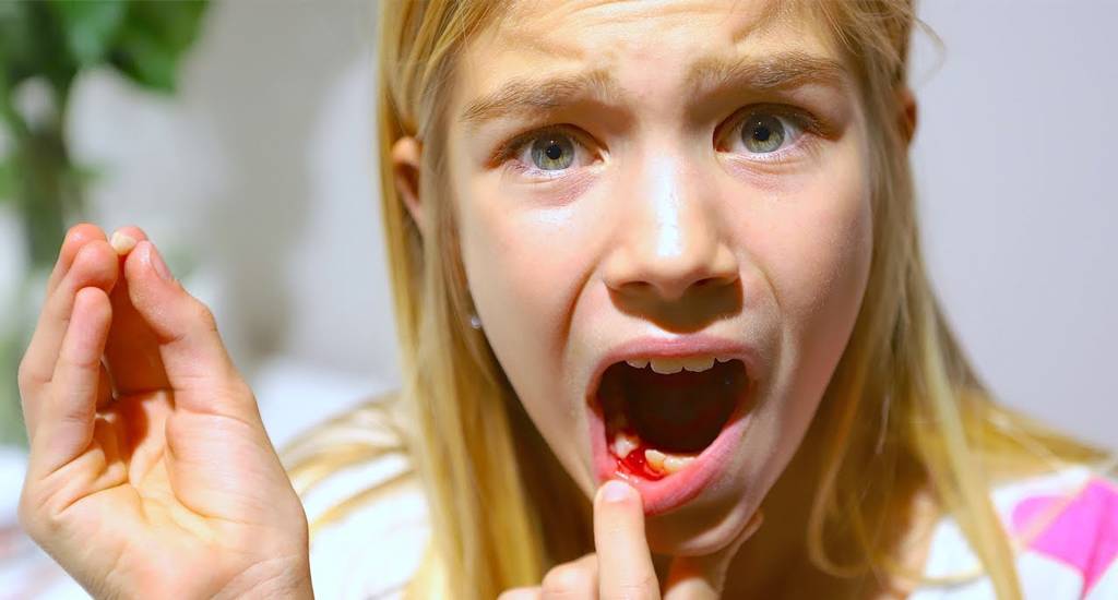 Как ребенку вырвать зуб в домашних условиях