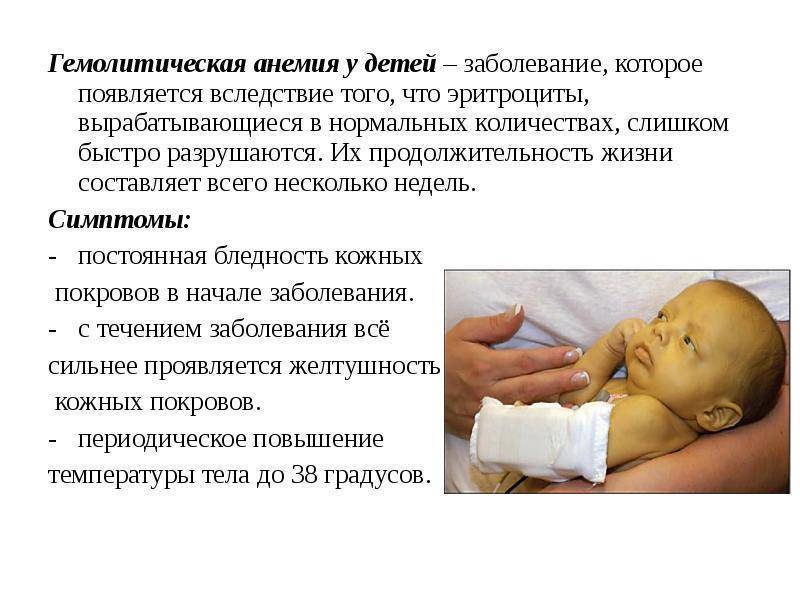Анемия у детей: симптомы, причины развития и лечение анемии у детей - yod.ua