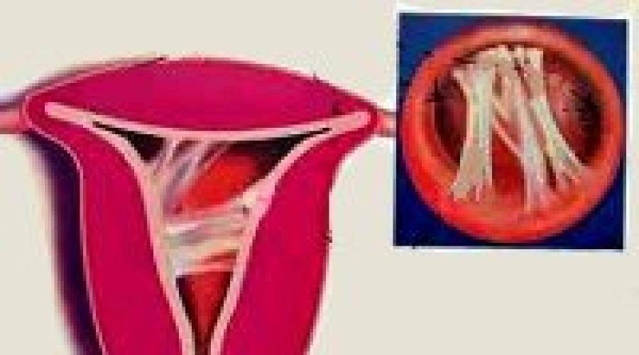 Сращение малых половых губ и другие патологии наружных половых органов у девочек от врача гинеколога