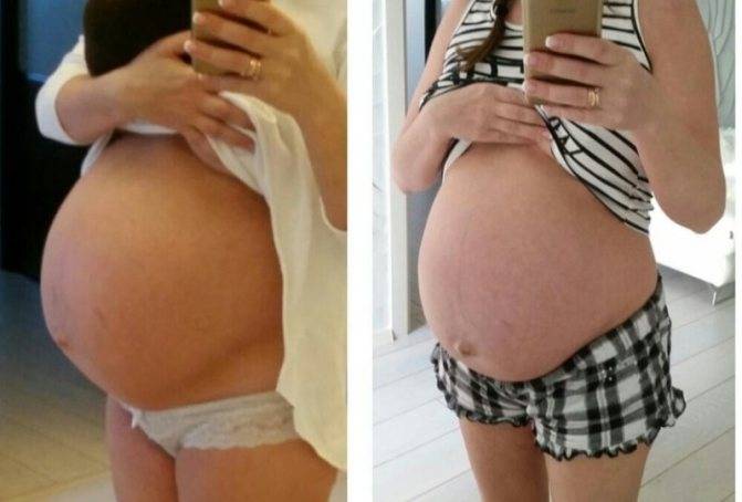 Запор перед родами, на 38, 39 или 40 неделе беременности: чем опасен, что делать?