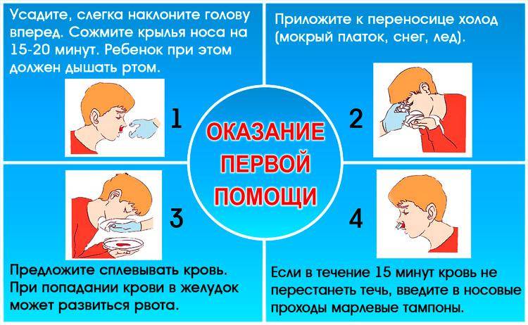 Причины кровотечения из носа у женщин: почему часто идет кровь — med-anketa.ru