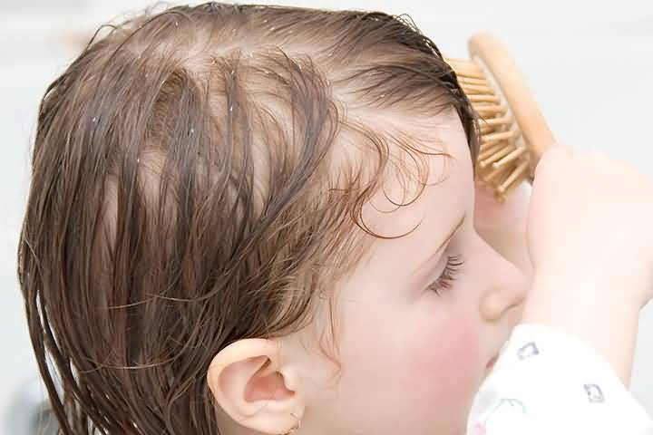 Почему у ребенка очень плохо растут волосы, выпадают: причины и коррекция проблемы у грудничков и детей постарше