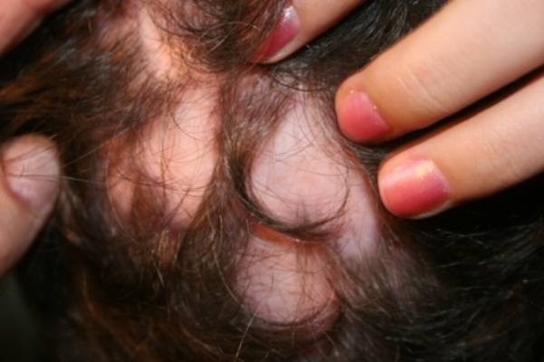 Волосы на ушах у новорожденного: причины, норма и отклонения, отзывы