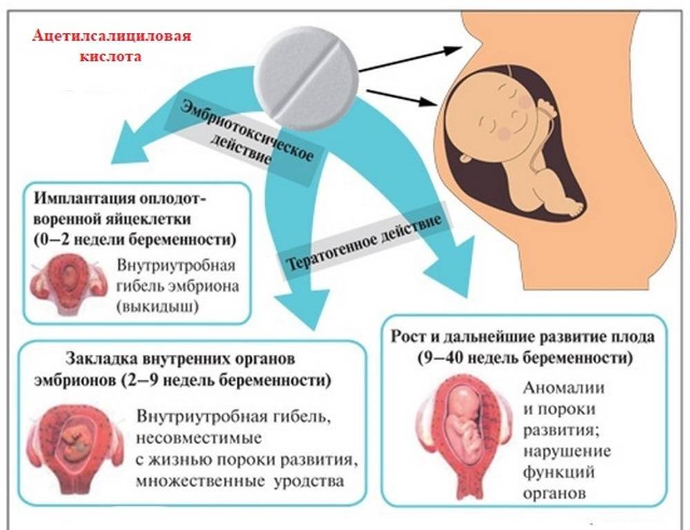 Какие препараты можно принимать от головной боли при беременности?