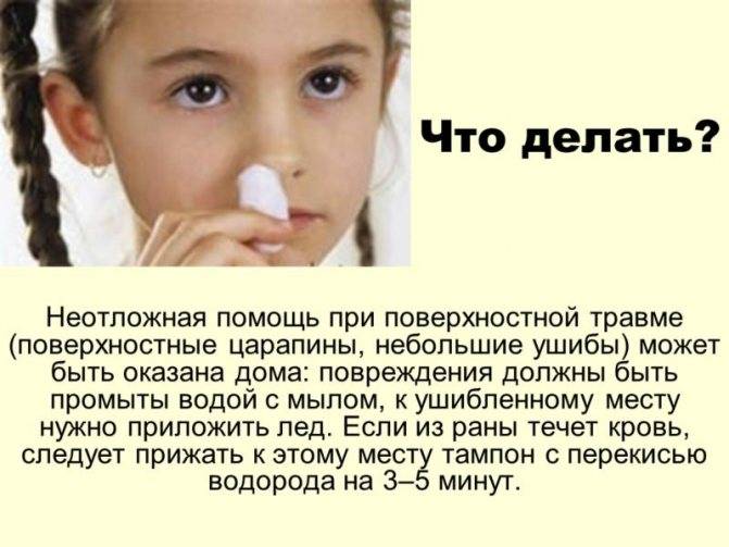Как определить перелом носа у ребенка: фото, симптомы, признаки и лечение