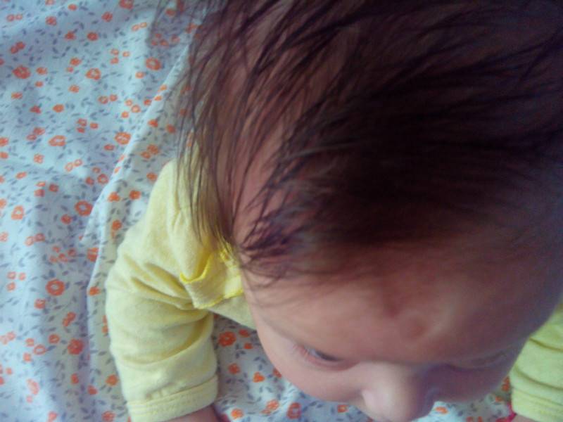 Большой лоб у ребенка: причины высокого, выпуклого, выпирающего вперед лба у младенца - детская поликлиника