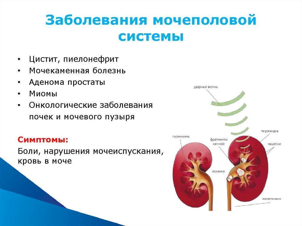 Диагностика и лечение заболеваний мочевыделительной системы у детей в москве