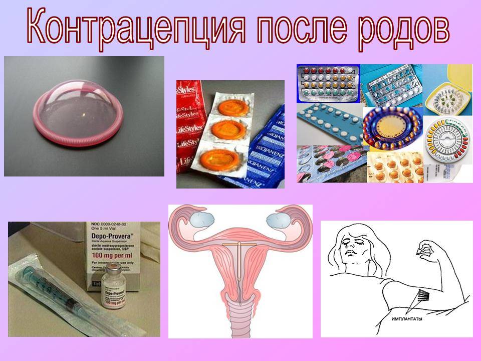 Методы, средства и способы контрацепции после родов