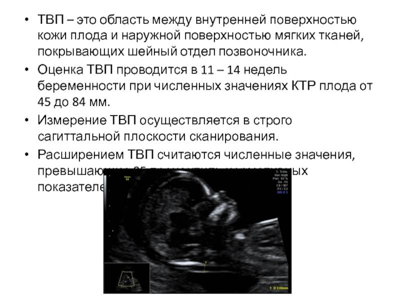 Норма твп в 12 недель беременности