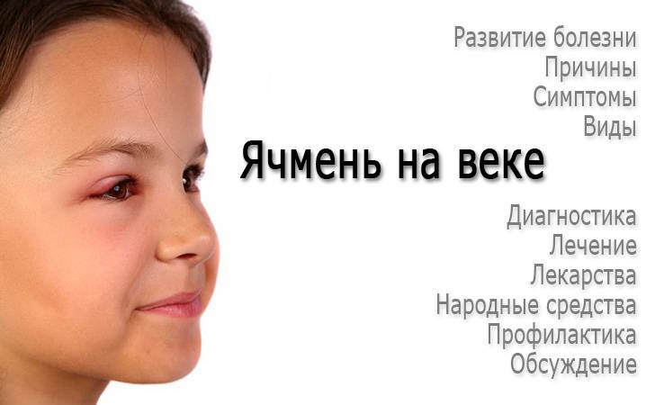 Причины реактивного отека век у детей и способы лечения - энциклопедия ochkov.net