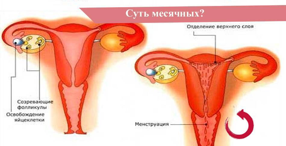 Аденомиоз матки: что это и как лечить - статья репродуктивного центра «за рождение»