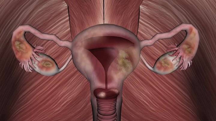 Двурогая матка и беременность | компетентно о здоровье на ilive