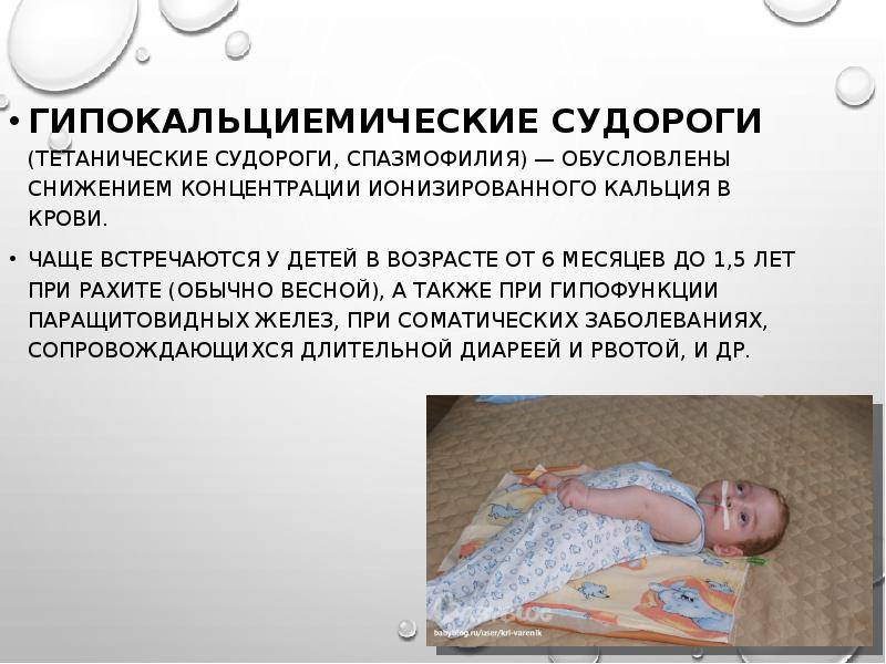 Судорожный синдром у детей - признаки, причины, симптомы, лечение и профилактика - idoctor.kz