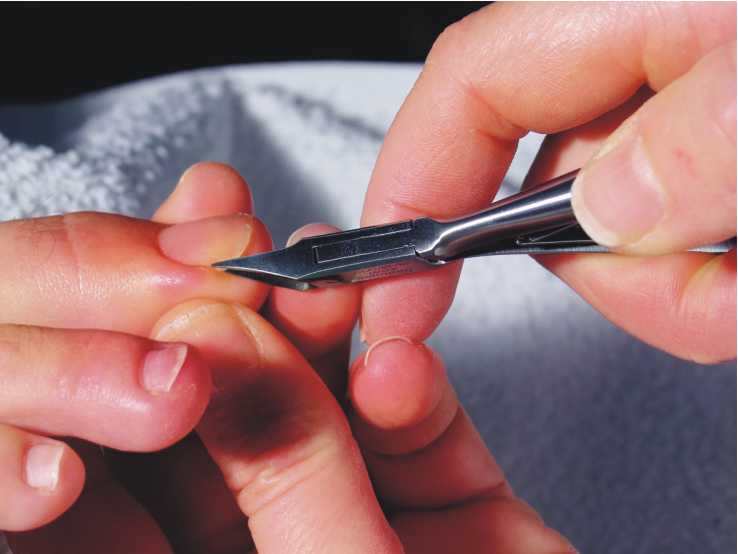 Как подстричь ногти новорожденному (проблема вросшего ногтя у грудничка)