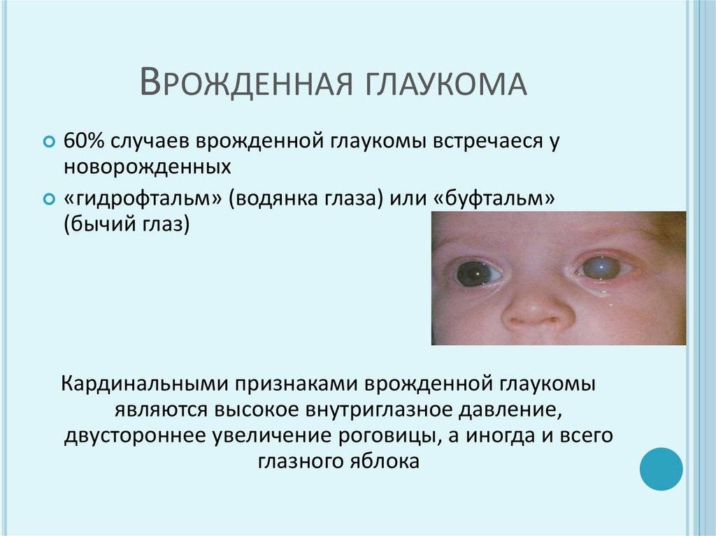 Лентикулостриарная ангиопатия у новорожденных: симптомы, лечение