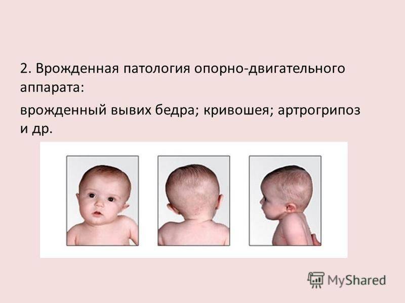 Череп новорожденного человека | анатомия черепа новорожденного, строение, функции, картинки на eurolab
