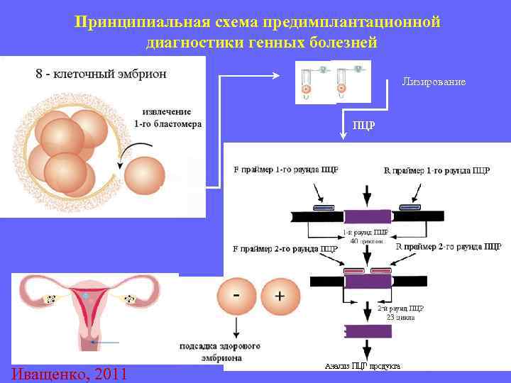 Генетическое исследование клеток ворсин хориона неразвивающейся беременности