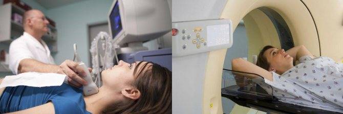 Конусно-лучевая компьютерная томография зубов