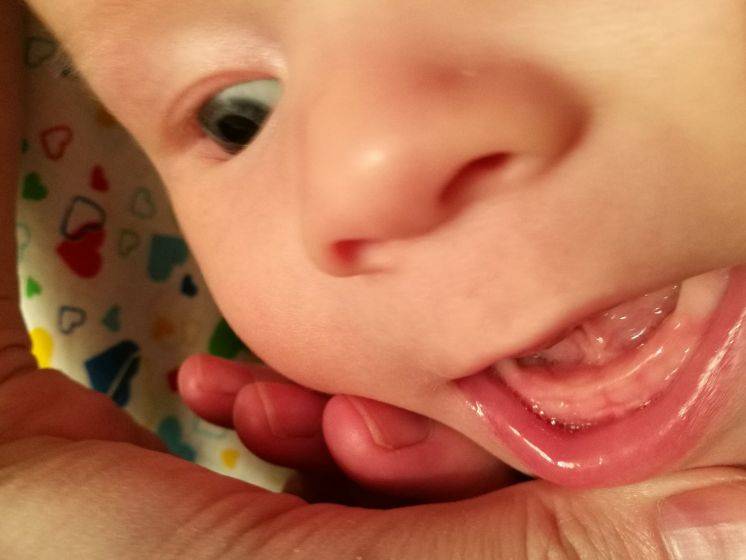 Как понять, что у младенца режутся зубки