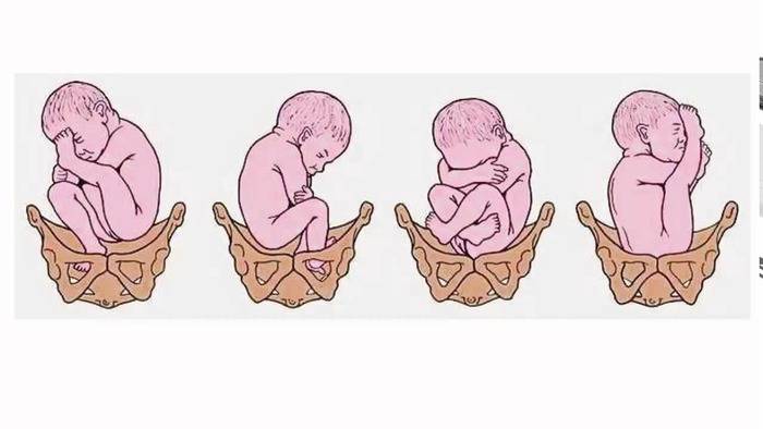 До какой недели беременности малыш может переворачиваться и когда малыш должен перевернуться перед родами