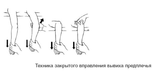 Боль в плечевом суставе: причины возникновения, диагностика и лечение