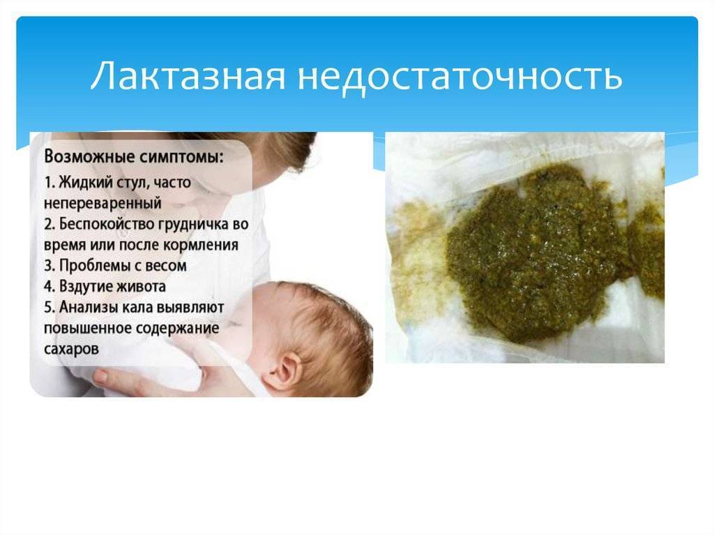 Пупочная грыжа у детей, лечение и операция - луняка андрей николаевич