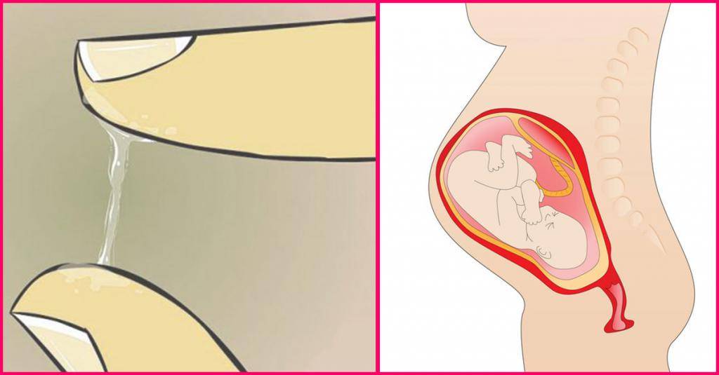 Дискомфорт во влагалище во время беременности