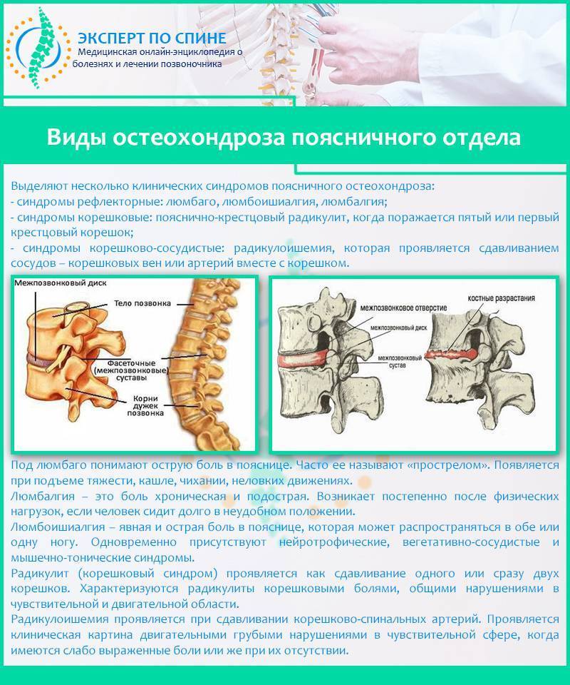 Остеохондроз причины заболевания компьютер