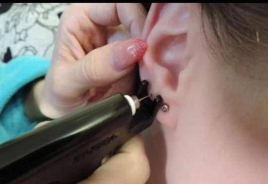 Не заживают уши после прокола у ребенка - сыктывкарская станция скорой медицинской помощи