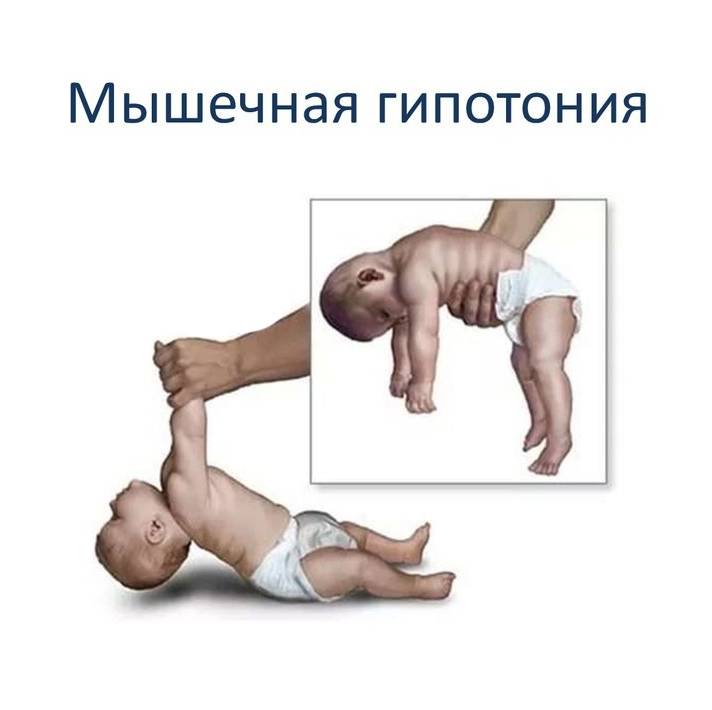 Как укрепить мышцы шеи ребенка