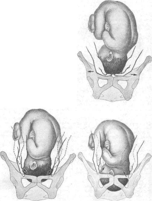 Низкое положение головки плода во время беременности: чем это плохо? головка опустилась раньше времени