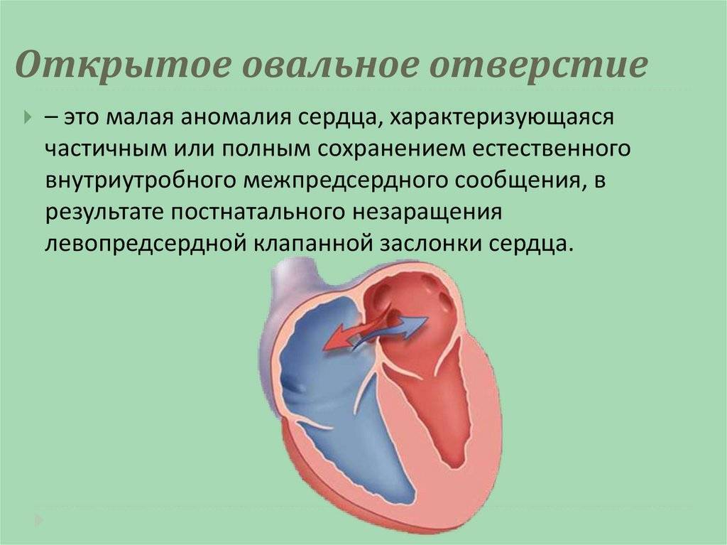 Пороки сердца врожденные и приобретенные: диагностика и лечение