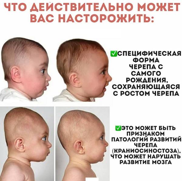 Размер головы у новорожденных по месяцам: нормальные показатели и отклонения от нормы