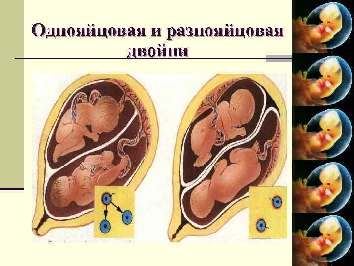 Редукция эмбрионов: методика, противопоказания, результаты