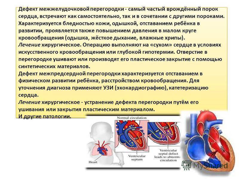 Эндоваскулярное лечение порока сердца