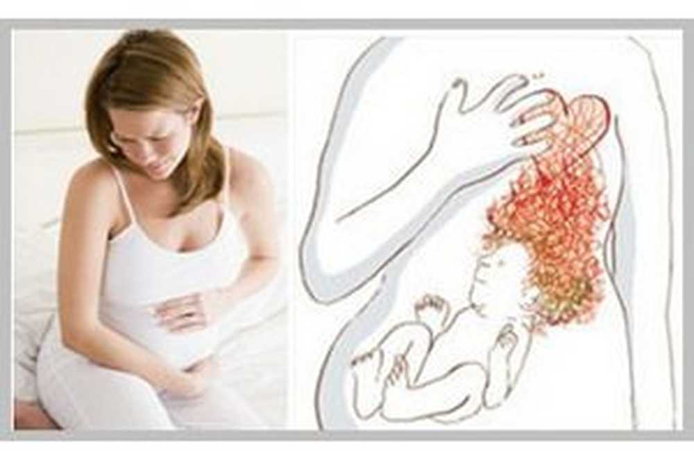 Ринит и беременность