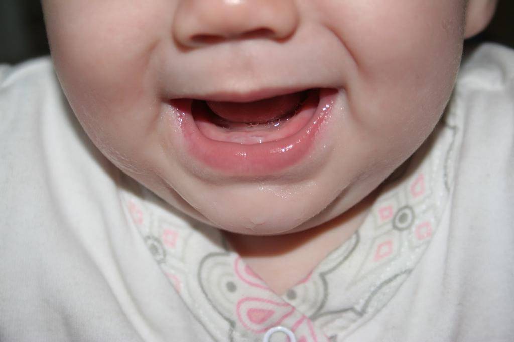 Первые зубы у младенцев: во сколько месяцев начинают прорезываться зубы, какие зубы у младенцев появляются первыми и сколько длится прорезывание молочных зубов у детей? как облегчить боль малышу при прорезывании зубов: советы педиатров | qulady