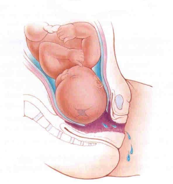 Влагалище после беременности и родов