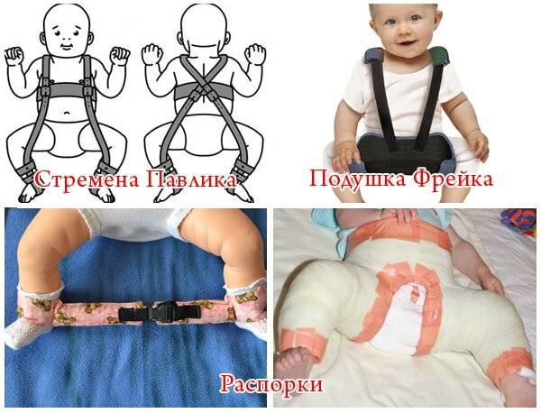 Рентген тазобедренного сустава в детском возрасте: особенности и правила проведения