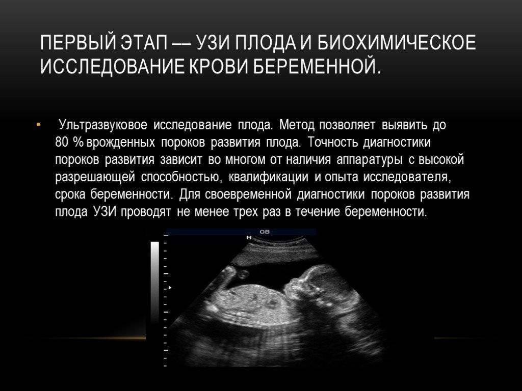 Пренатальная диагностика хромосомных аномалий - наблюдение беременности.  здоровье