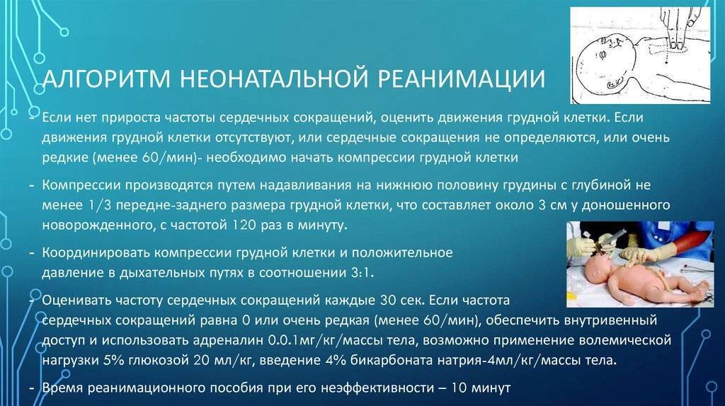 Отделение реанимации и интенсивной терапии новорожденных