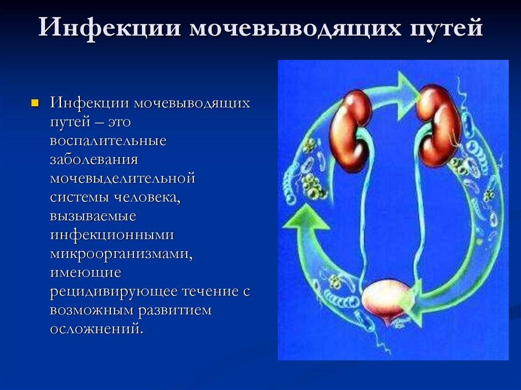 Симптомы, причины и лечение почечной инфекции (пиелонефрит)