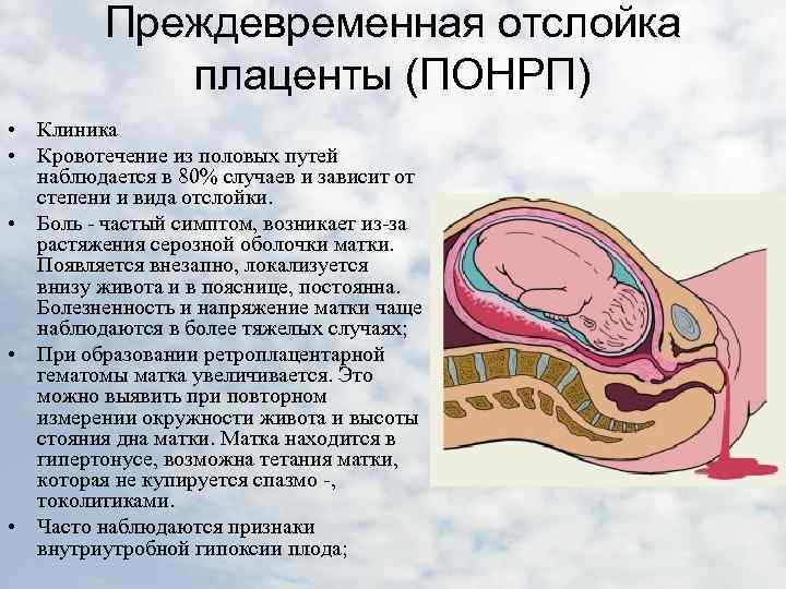 Гипоплазия плаценты при беременности: что это такое и чем грозит для плода?