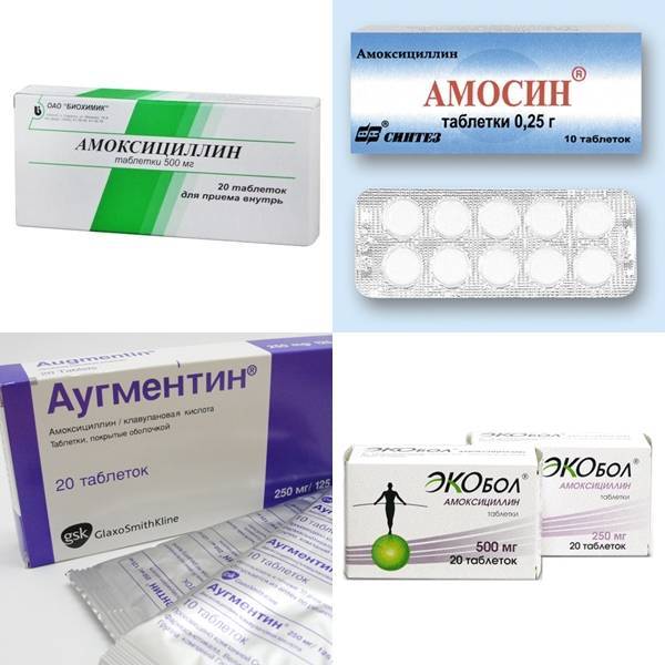 Антибиотики при ангине у детей: список с лучших препаратов для горла от 3 лет