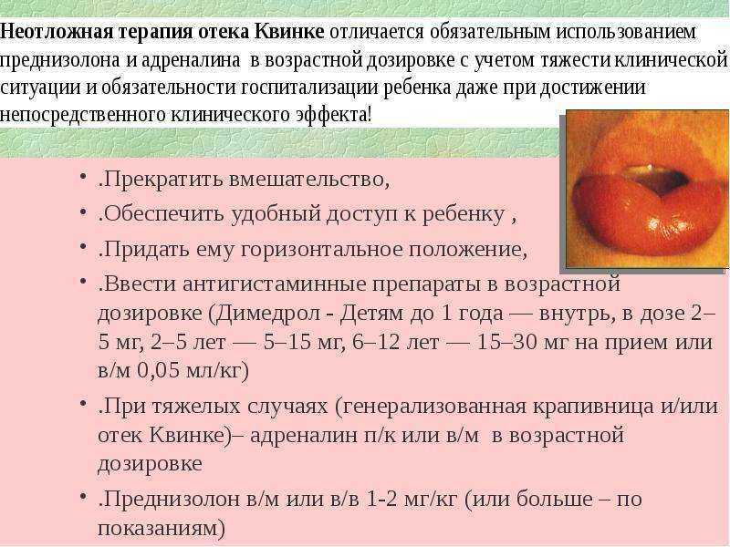 Отек квинке, отек век, губ или языка
