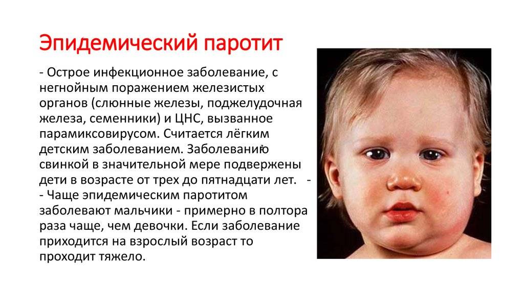 Свинка